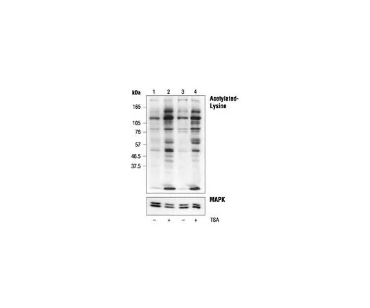 62-8533-34 Anti-Acetylated Lysine Rabbit pAb ST1027-50UL