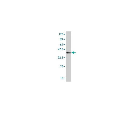 62-8534-01 Anti-MSLN Mo*** mAb (1A10) ST1660-100UG