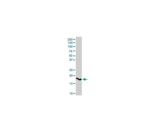 62-8477-58 Anti-SPINK1 Rabbit pAb AP1142-100UG