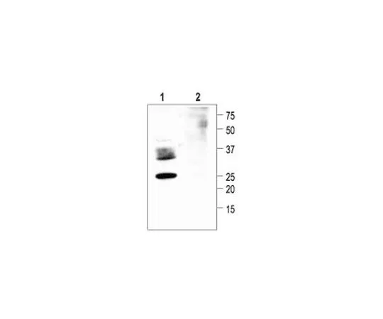 62-8408-40 Anti-Aquaporin 2 (254-271) Rabbit Polyclonal Antibody 178612-1ST