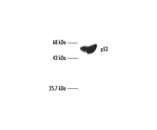 62-8529-09 Anti-p53 (Ab-6) (Pantropic) Mo*** mAb (DO-1) OP43-100UG
