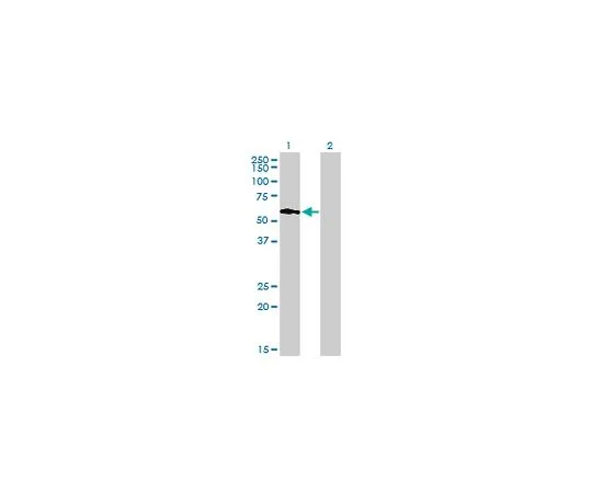 62-8533-58 Anti-PIP5K3 Mo*** mAb (6C7) ST1517-100UG