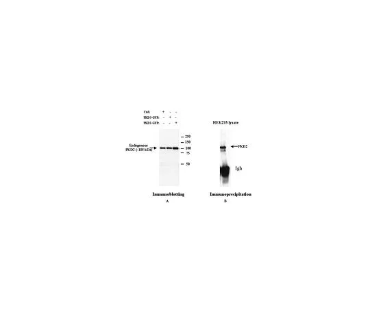 62-8533-38 Anti-PKD2 Rabbit pAb ST1042-50UG
