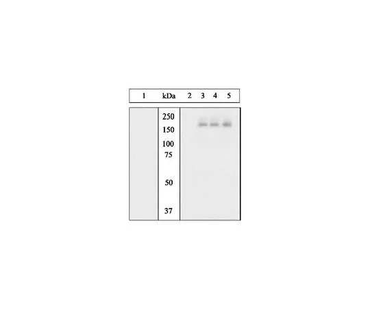 62-8417-63 PhosphoDetect(TM) Anti-Epidermal Growth Factor Receptor (pTyr1068) Rabbit pAb 324867-10T