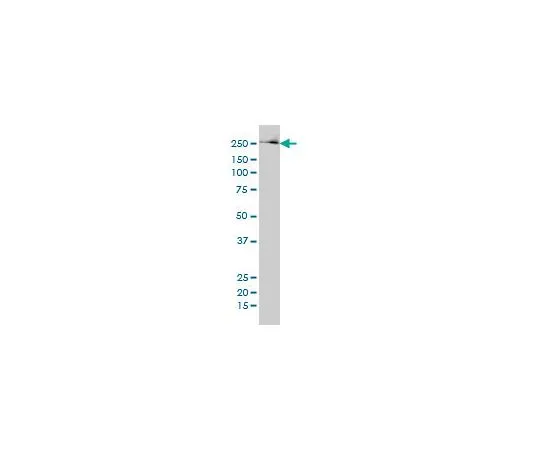 62-8533-65 Anti-FASN Mo*** mAb (3F2-1F3) ST1549-50UG