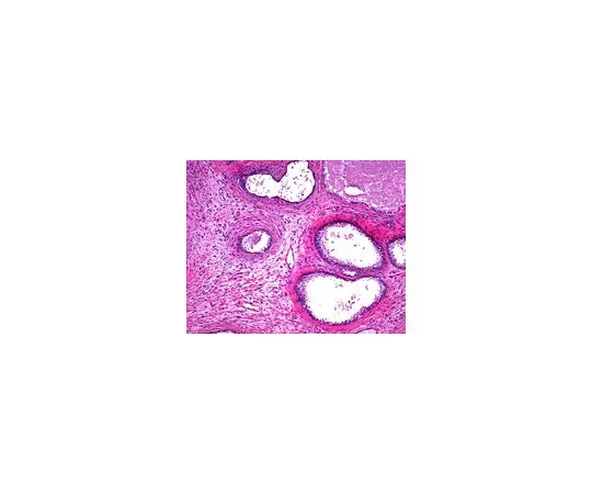 62-8535-97 Eosin Y solution 1%, alcoholic for microscopy 1.17081.1000