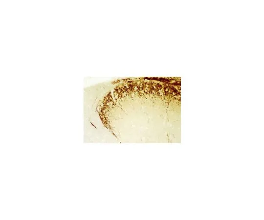 62-8529-72 Anti-Calcitonin Gene Related Peptide (CGRP) Rabbit pAb PC205L-100UL