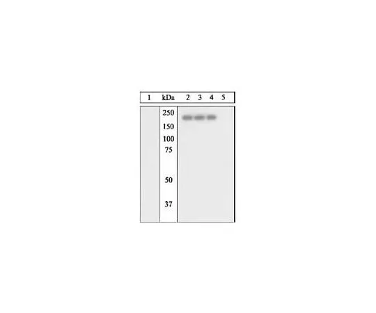 62-8417-62 PhosphoDetect(TM) Anti-Epidermal Growth Factor Receptor (pTyr845) Rabbit pAb 324865-10T