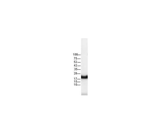 62-8529-07 Anti-Pan-Ras (Ab-3) Mo*** mAb (RAS 10) OP40-100UG
