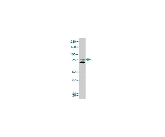62-8534-22 Anti-SMO Mo*** mAb (1D9) ST1718-100UG