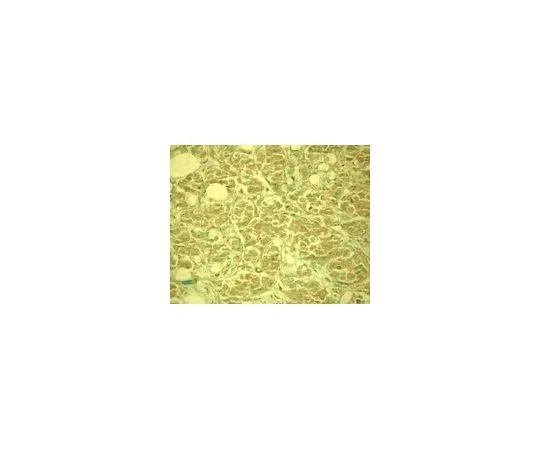 62-8529-38 Anti-MDM2 (Ab-3) Mo*** mAb (4B11) OP143-100UG