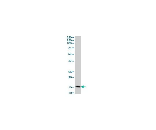 62-8534-17 Anti-TOMM20 Mo*** mAb (4F3) ST1705-100UG