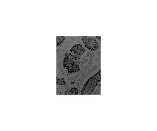 62-8371-19　［Discontinued］Anti-VEGF, clone JH; 100 μg　05-443