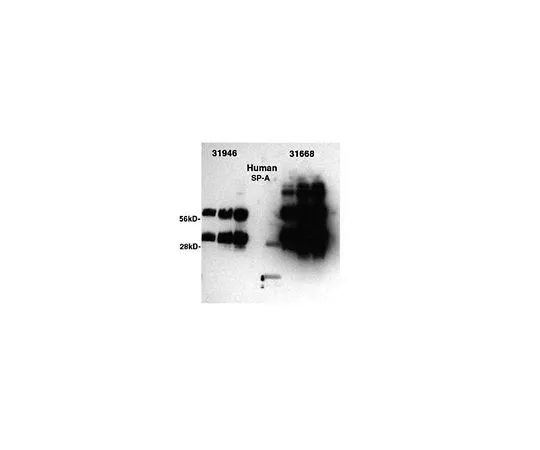 62-8494-61　［Discontinued］Anti-Surfactant Protein A, clone #10; 100 μL　MAB3280