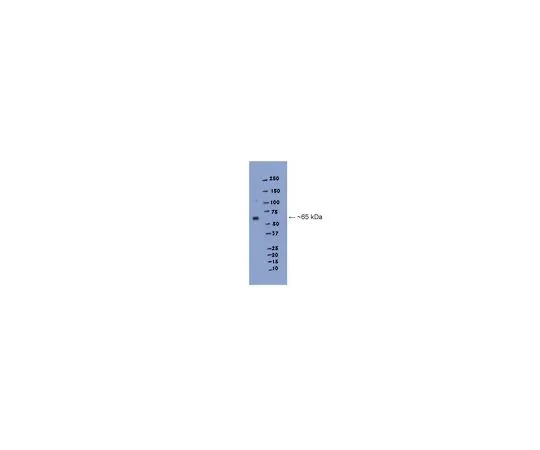 62-8454-79　［Discontinued］Anti-Glycine Receptor alpha1; 100 μg　AB15012