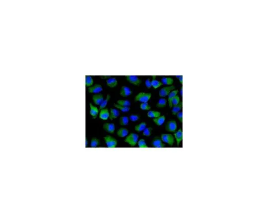 62-8512-58　［Discontinued］Anti-DcR1, clone EPR6162, Rabbit Monoclonal　MABF761