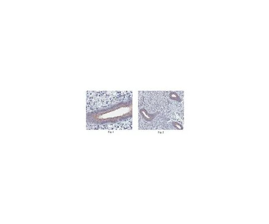 62-8473-22　［Discontinued］Anti-Protocadherin 19 Antibody, Cat No. ABT188　ABT188