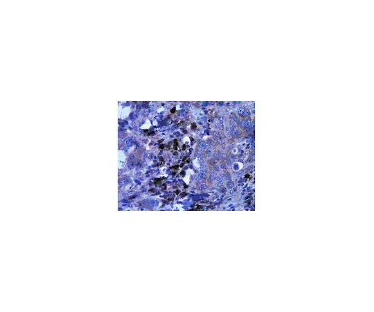 62-8456-33　［Discontinued］Anti-ATG5; 100 μg　ABC14