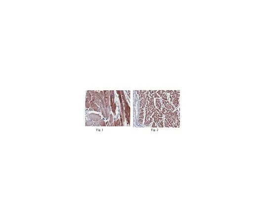 62-8473-01　［Discontinued］Anti-Obscurin Antibody ,Cat. No. ABT160　ABT160