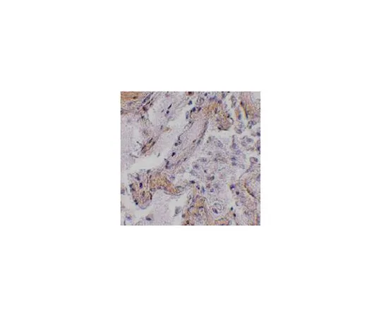 62-8473-85　［Discontinued］Anti-CAPN6　ABT404