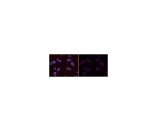 62-8500-45　［Discontinued］Anti-MGMT Antibody, clone MT 3.1, Alexa Fluor(R) 647 Conjugate　MAB16200-AF647