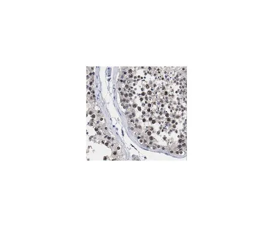 62-8458-23　［Discontinued］Anti-HIAP-2 (CIAP-1)　ABC448