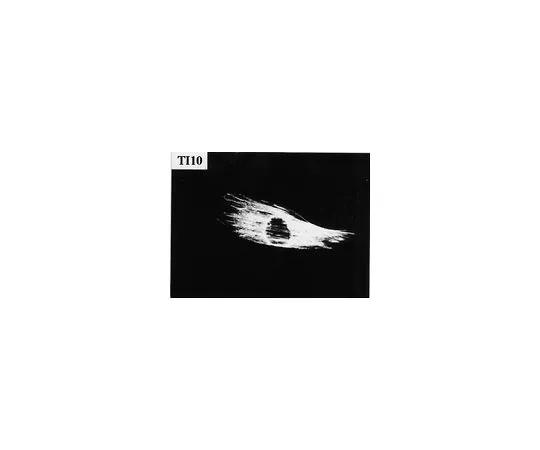 62-8491-74　［Discontinued］Anti-Filamin A, clone TI10; 100 μL　MAB1680