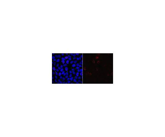 62-8463-90　［Discontinued］Anti-phospho Mis18-binding protein 1 (Thr702) Antibody　ABE1847