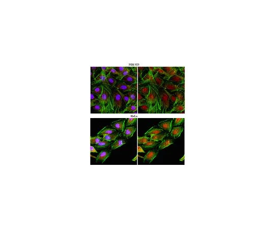 62-8383-23　［Discontinued］Anti-CHD-1; 100 μg　06-1339
