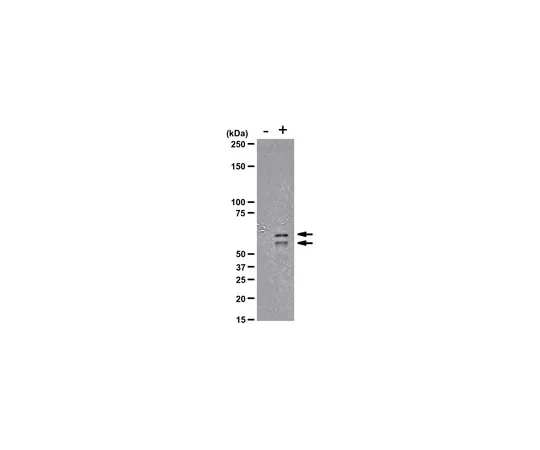 62-8368-71　［Discontinued］Anti-phospho-PPARγ (Ser82), clone AW504; 100 μl　04-816