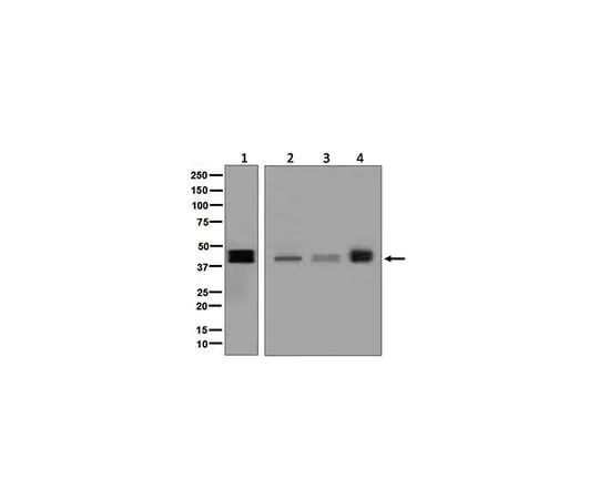 62-8512-55　［Discontinued］Anti-TFPI, clone EPR7941, Rabbit Monoclonal　MABF757
