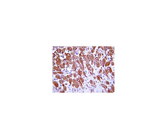 62-8382-96　［Discontinued］Anti-Protein patched homolog 2; 100 μg　06-1103