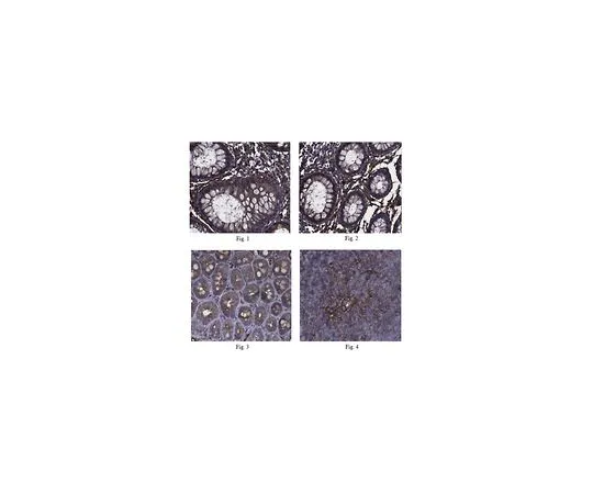62-8457-04　［Discontinued］Anti-Annexin A2 Antibody, Cat. No. ABC152　ABC152