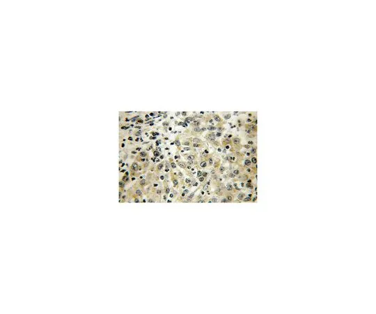 62-8457-40　［Discontinued］Anti-CYP4F12　ABC261