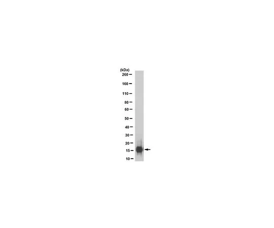 62-8524-81　［Discontinued］Anti-FABP2 Antibody, clone 4F6.1　MABS1694