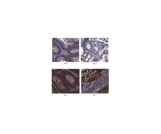 62-8472-98　［Discontinued］Anti-CO-029 Antibody, Cat. No. ABT156　ABT156