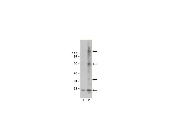 62-8392-20　［Discontinued］Anti-Nitrotyrosine, clone 1A6, agarose conjugate; 100 μg　16-163