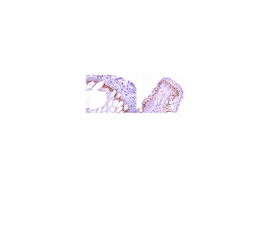 62-8381-05　［Discontinued］Anti-ROR2, C-terminus; 100 μg　06-018