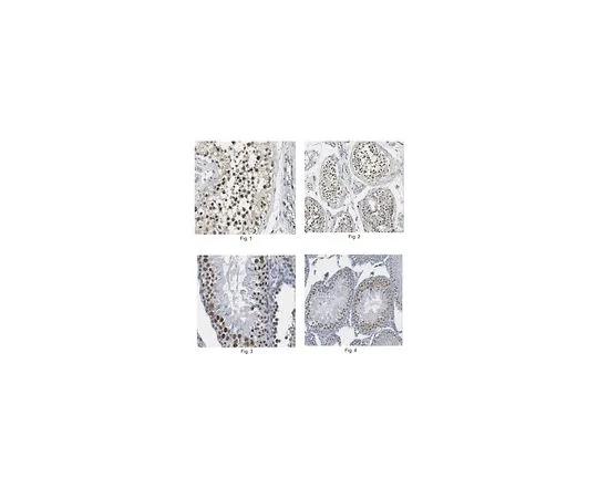 62-8457-55　［Discontinued］Anti-RIF1　ABC302