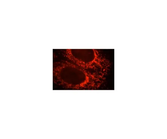 62-8470-28　［Discontinued］Anti-ETFB　ABS472