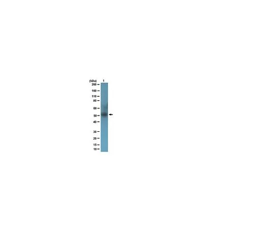 62-8387-06　［Discontinued］Anti-SUV39H1; 100 μg　07-958