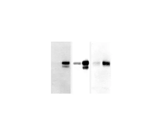 62-8497-12　［Discontinued］Anti-Amyloid, beta 1-16, clone DE2; 2 mL　MAB5206