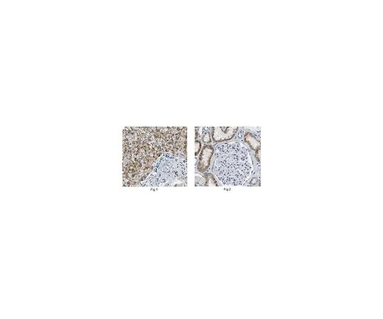62-8518-91　［Discontinued］Anti-PhyH / PAHX Antibody, clone N210/5 Cat. No. MABN660　MABN660