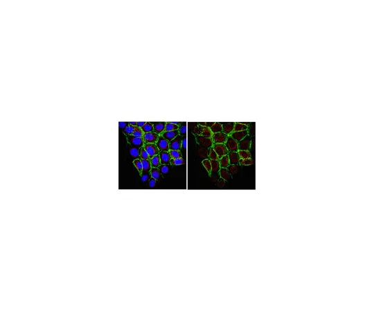 62-8374-18　［Discontinued］Anti-B-Raf, clone 4B3.2; 100 μg　05-1094