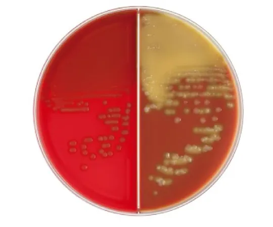 63-6527-83 BD BBL (TM) TSAII 5% sheep blood agar/chocolate II agar with bacitracin 20 plates 251789