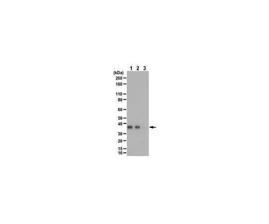 62-8458-30　［Discontinued］Anti-phospho TRADD Antibody (Ser215) Cat. No. ABC461　ABC461