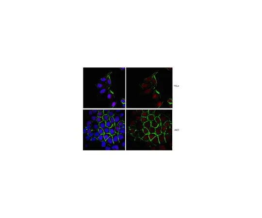 62-8521-76　［Discontinued］Anti-Ubch9; 100 μg　MABS17