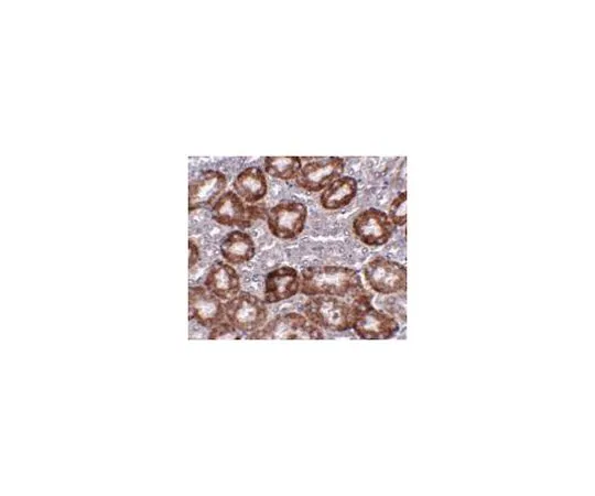 62-8467-51　［Discontinued］Anti-RTP801　ABN483