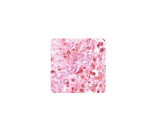 62-8522-49　［Discontinued］Anti-CACYBP, clone 7D11　MABS420