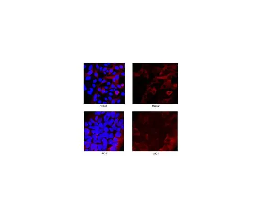 62-8501-47　［Discontinued］Anti-RRM2, clone 4D1.2　MABC154